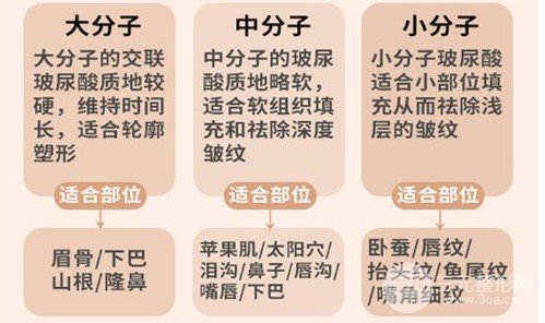 醫(yī)生如何注射玻尿酸