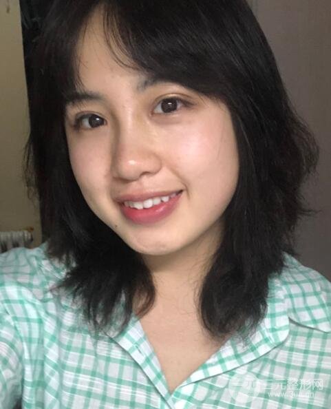 耳軟骨墊鼻尖失敗手術時