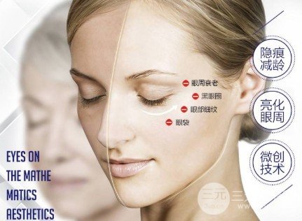 抽脂去眼袋費用貴