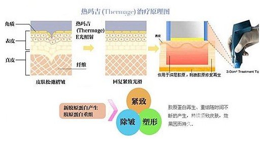 熱瑪吉原理功