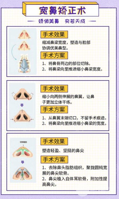 鼻梁歪整形手術(shù)果