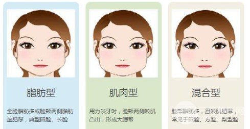 注射瘦臉