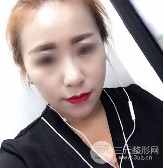 注射瘦臉