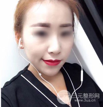 注射瘦臉