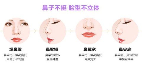自體隆鼻價(jià)格多少