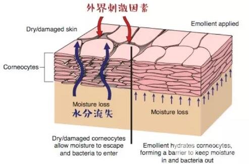來了！你的敏感皮膚“自救”指南