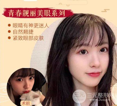 開外眼角前后對比