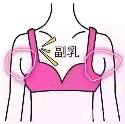 【科普】副乳切除手術(shù)幾天恢復(fù)？手術(shù)注意事項(xiàng)~