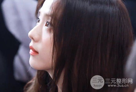墊下巴前后對(duì)比圖