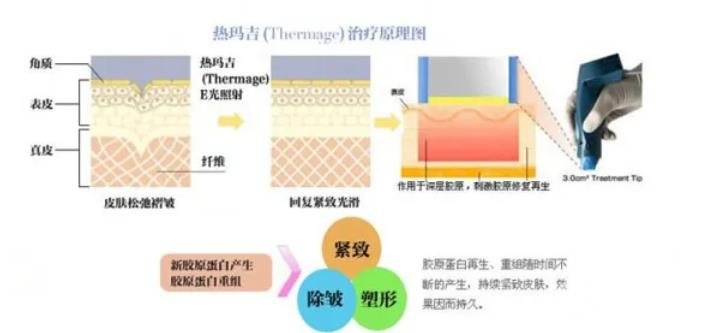 熱瑪吉的恢復期