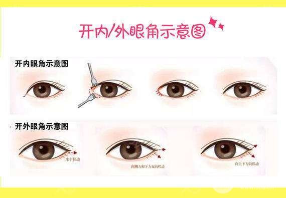 開眼角有什么好處