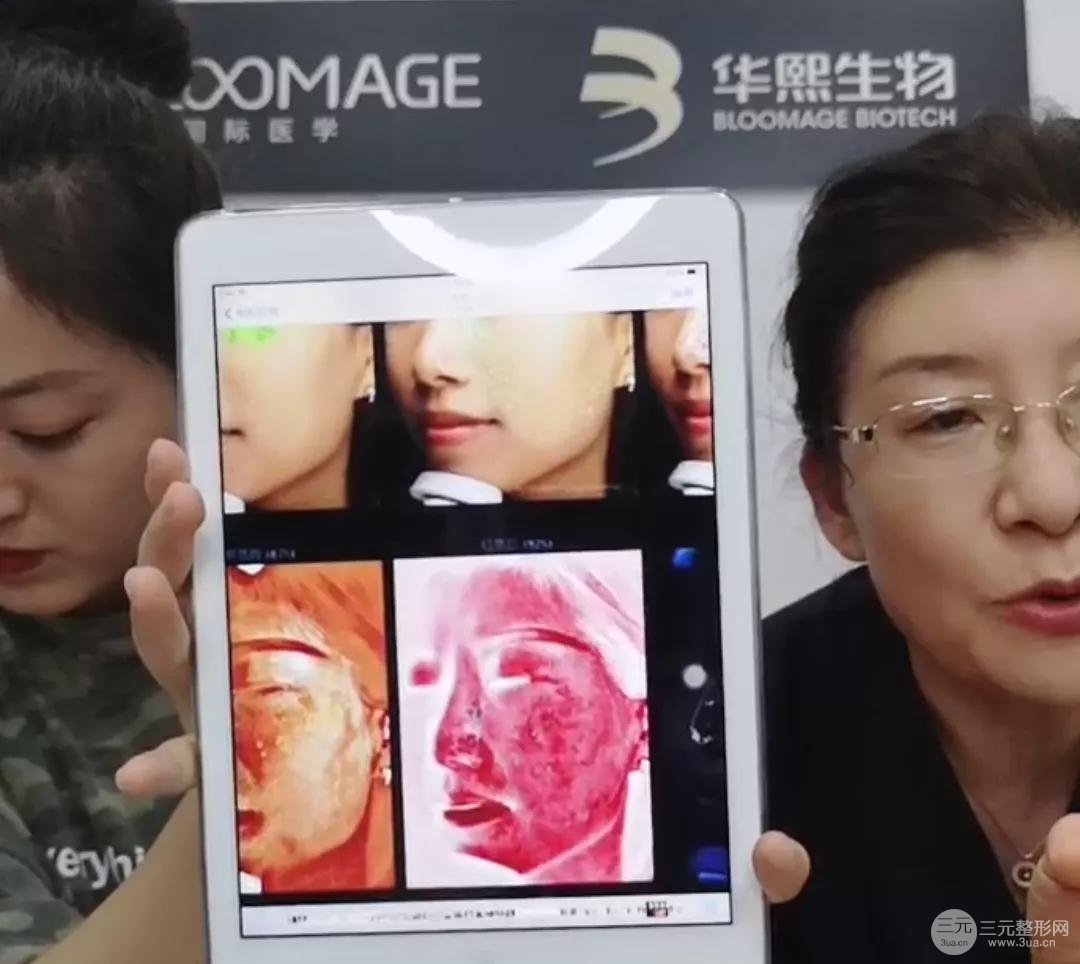 皮膚檢測