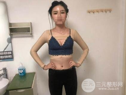 術后恢復過程