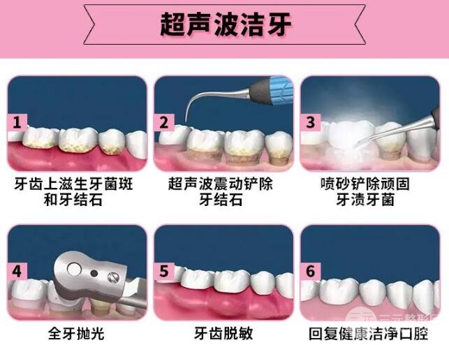 潔牙
