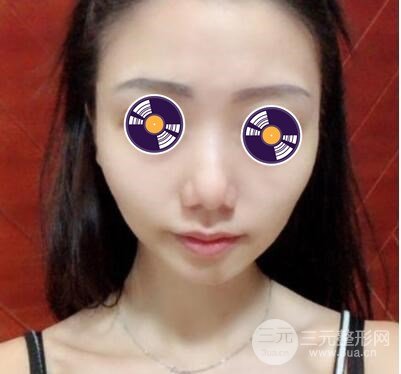 手術(shù)后多久可以上班?
