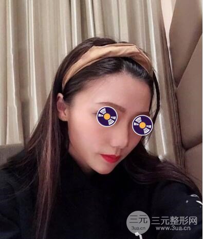 手術(shù)后多久可以上班?