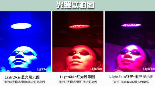 紅藍(lán)光緩解痤瘡什么人不適合做