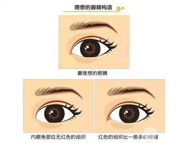 割雙眼皮開眼角手術(shù)注意事項(xiàng)