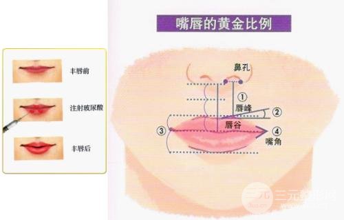 注射玻尿酸豐唇后多久可以涂口紅