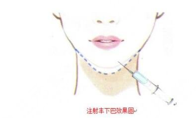 為了避免后遺癥需要注意什么?