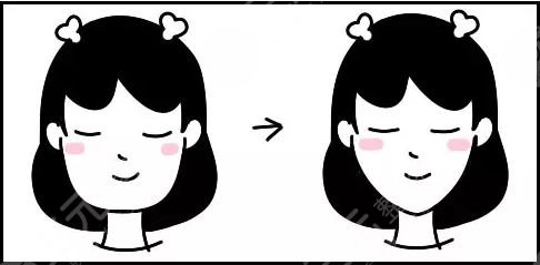 怎樣變瓜子臉