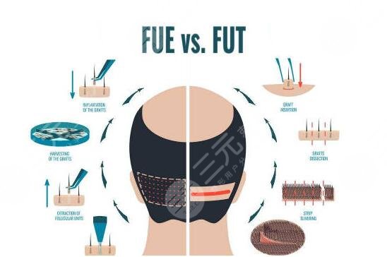 成都植發(fā)醫(yī)院排行：實(shí)力派靠譜植發(fā)機(jī)構(gòu)盤(pán)點(diǎn)~