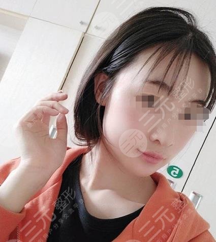山大二院美容整形外科臉部下頜骨果圖