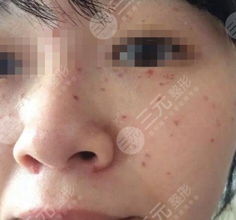 北京市海淀醫(yī)院整形美容科
