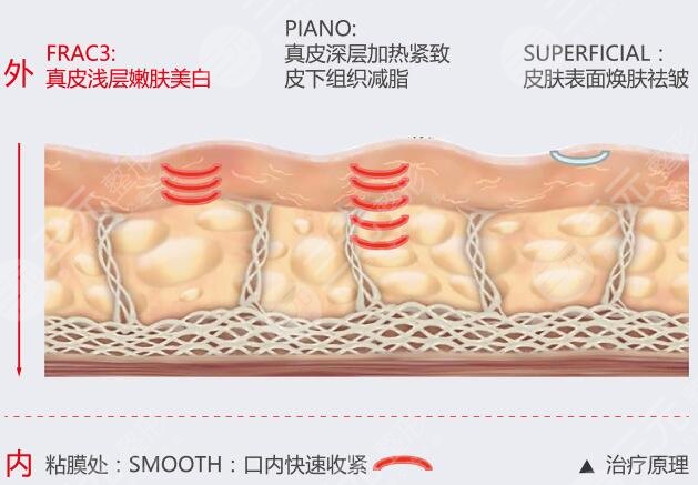 優(yōu)點(diǎn)對(duì)比