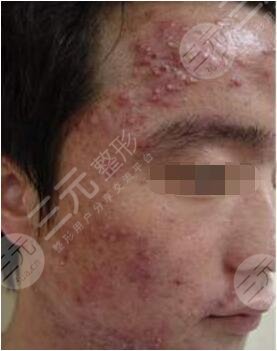 北京伊美爾幸福美容?？漆t(yī)院