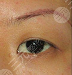 北京亞峰醫(yī)療美容診所