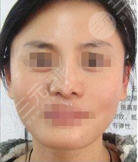 北京伊美爾美容健翔醫(yī)院