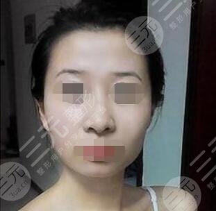 北京軍區(qū)總醫(yī)院激光整形中心