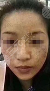 北京空軍總醫(yī)院激光整形美容中心