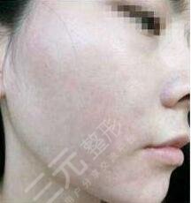 北京中關(guān)村醫(yī)院激光整形美容中心