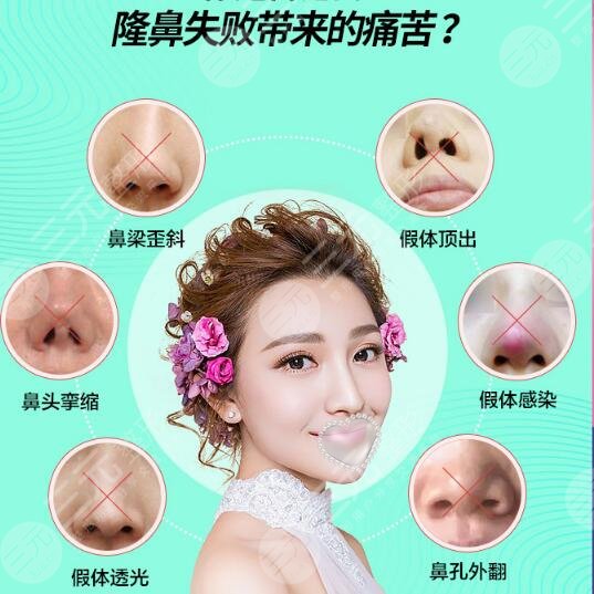 隆鼻假體取出術(shù)