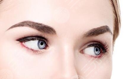 有沒有必要去開眼角？