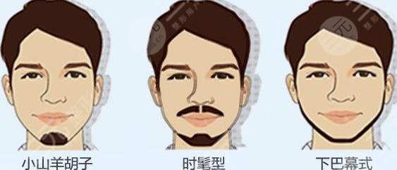 胡須種植適合哪些人群？