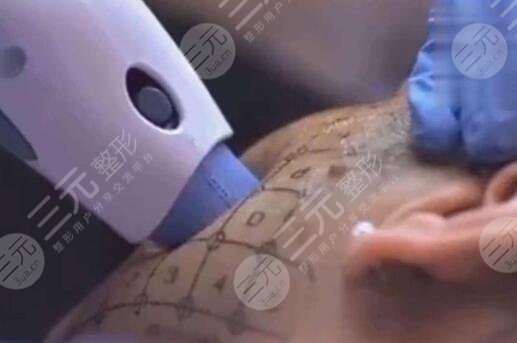 影響熱瑪吉價格的因素