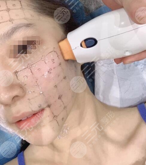 熱瑪吉多久做一次合適