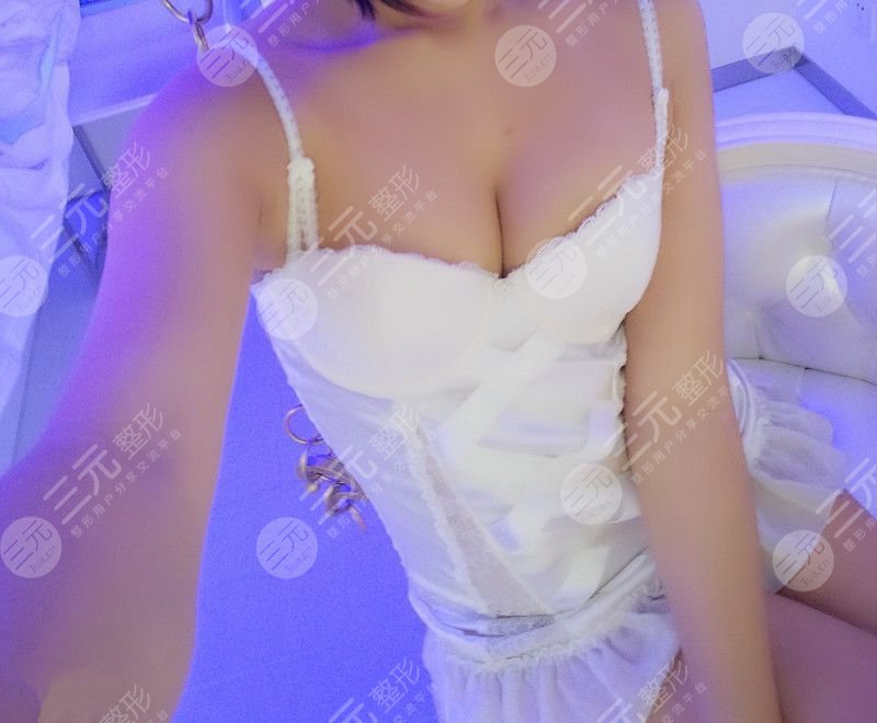 乳房縮小術(shù)前后對比,看了你就相信杭州美來比較好!