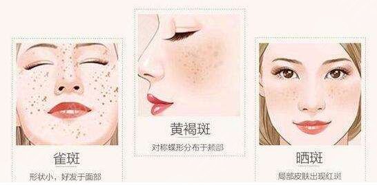 彩光去雀斑的注意事項
