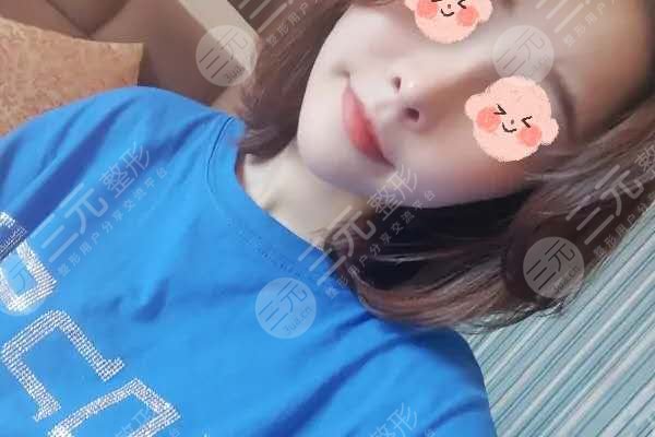 上海九院隆鼻價目表2020大公開，還有漂亮的隆鼻果分享哦！