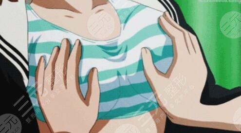 重慶自體脂肪隆胸，1個半月后的果