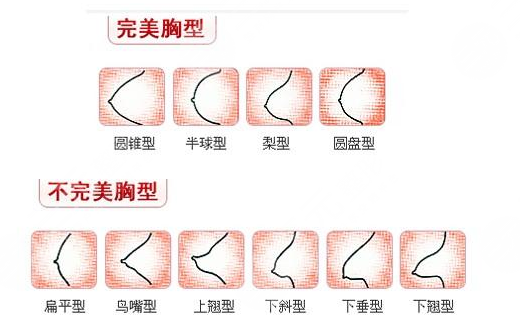 隆胸