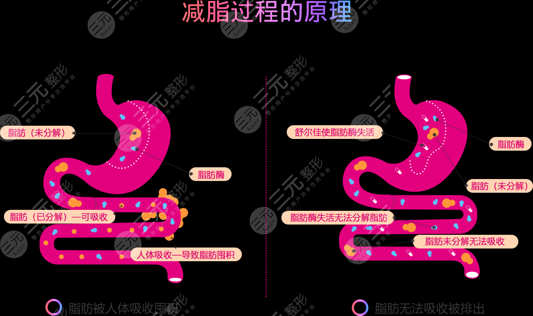 奧利司他膠囊原理
