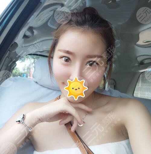 上海九院王煒做鼻子怎么樣