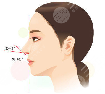 自體軟骨移植隆鼻術(shù)
