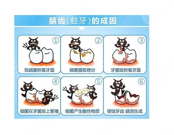 哪些因素會影響補牙價格