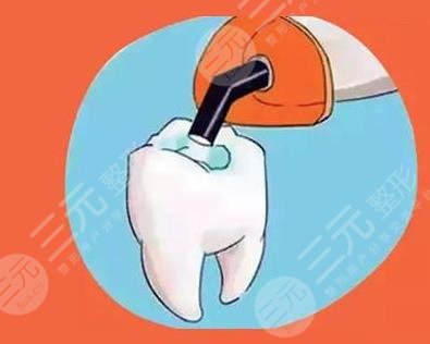 蛀牙補牙要多少錢